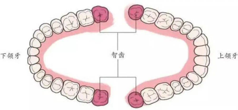 一般从正中的门牙往里数,数到了 第八颗牙齿:恭喜你,是被智齿宠爱的