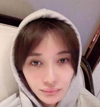 双眼皮明显变宽,素颜状态下眼睛略显疲惫.