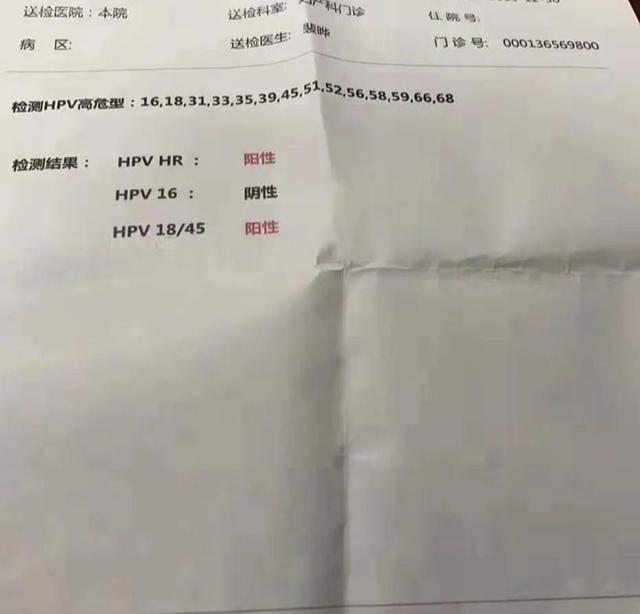 邵女士今年29岁,感染hpv6年多,曾经做过2次锥切手术,可这次复查,又