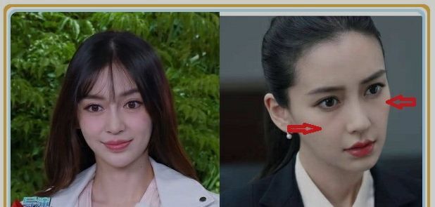 baby杨颖脸上现整容后遗症baby真的整容过吗我们一起来看看