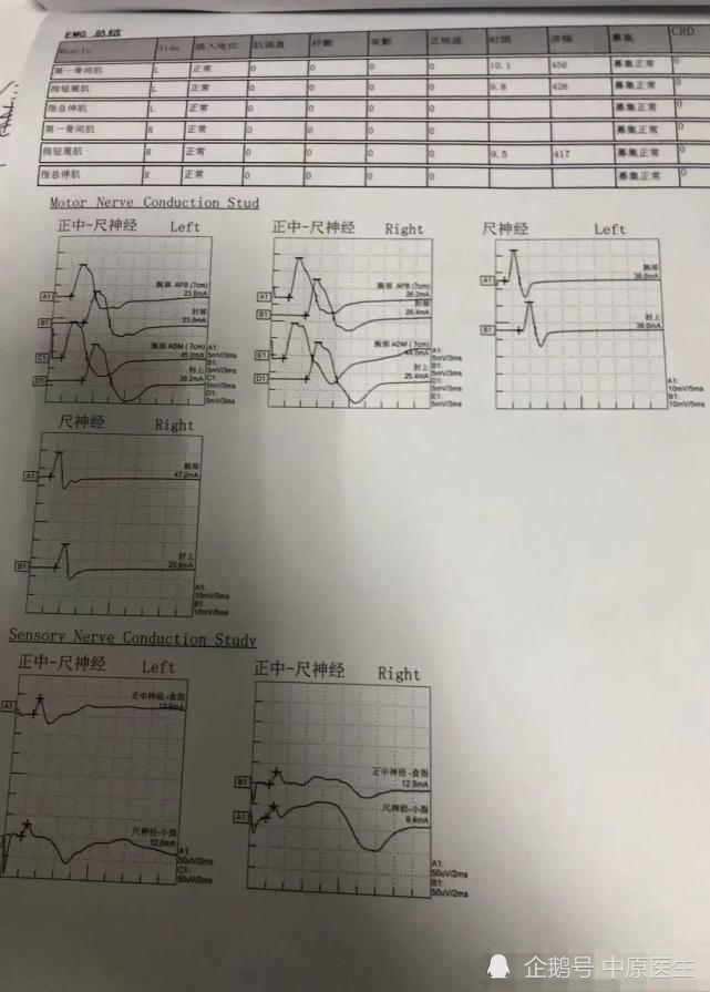 女子通过网络上的科普把自己诊断为渐冻症,做了一堆检查,被专家排除