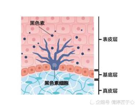 原本是人的皮肤对于紫外线的伤害产生的一种保护机制,是由黑色素细胞