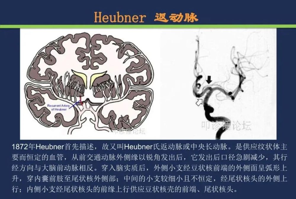 从梗死部位推测责任血管:脑血管解剖