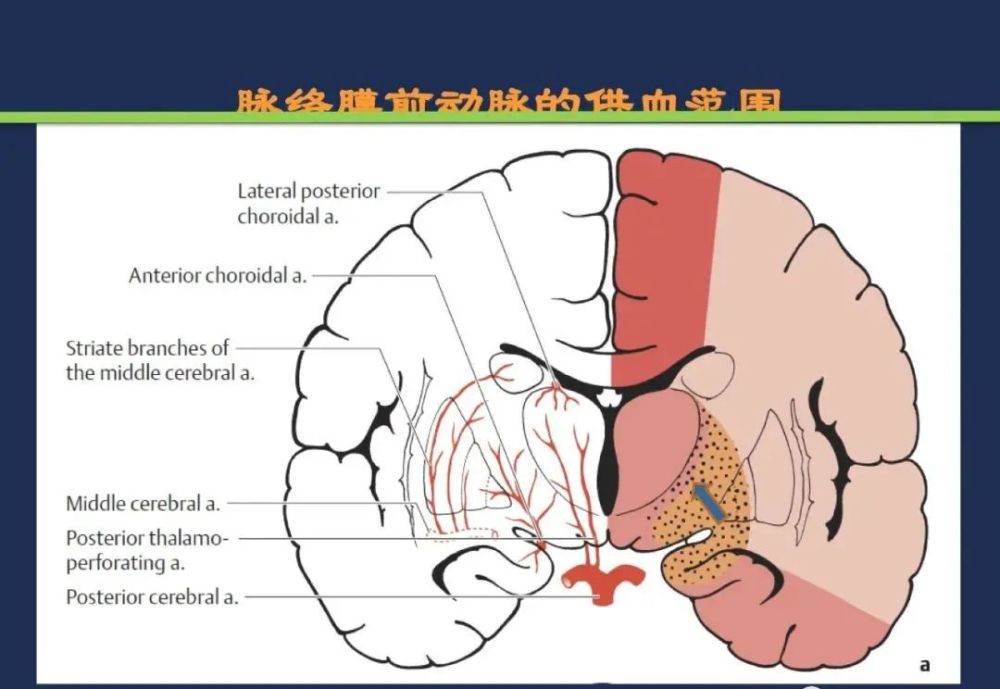 丘脑结节动脉 小脑前上动脉 脑桥旁正中动脉 小脑前下动脉 小脑后下