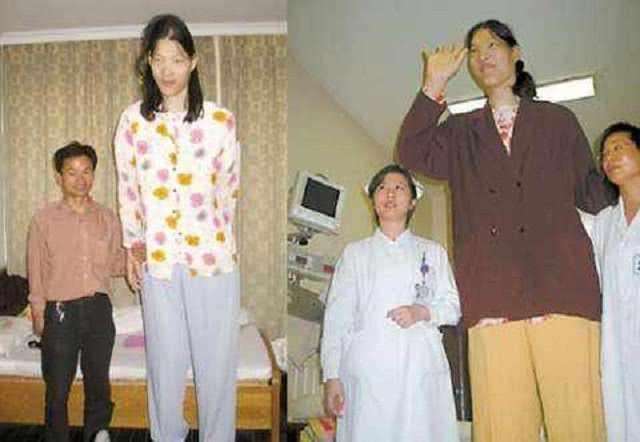 她是中国长得最高的女人,一岁能吃近两斤米饭,18岁就长到2.48米