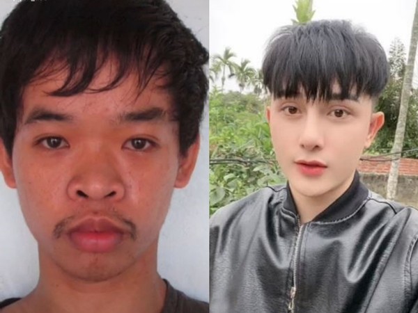 越南失业男花天价9次整容撞脸张东健,大方晒整容前丑照,人生意外改变