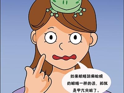 贵阳甲乳医院:甲亢突眼是什么样的?