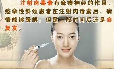 注射肉毒素就能治好痉挛性斜颈只是一种假象而已