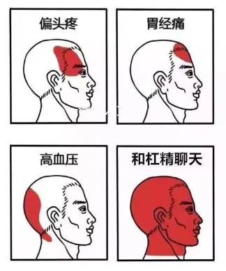 这四种头痛没这么简单,早知道早预防