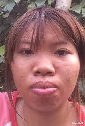 越南凤姐郭金凤:花9万整容后嫁富二代,女儿颜值成亮点