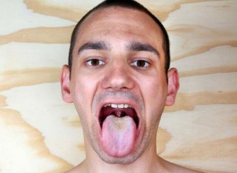 脾胃虚弱会导致舌头胖大,需要引起一定的重视