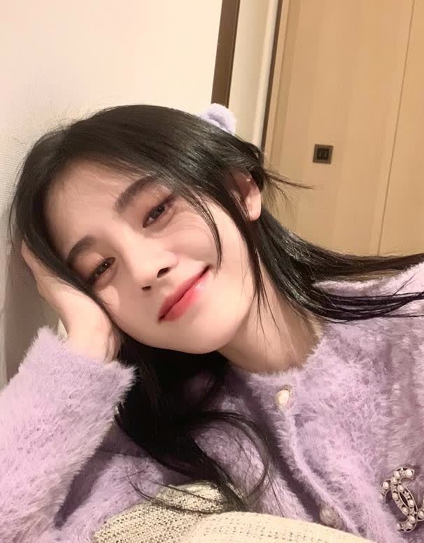 鞠婧祎晒公主切美照怼脸镜头下双眼皮疤痕明显画面扎心了