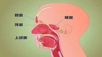 鼻窦左右成对,共四对,分别称为额窦,上颌窦,蝶窦和筛窦.