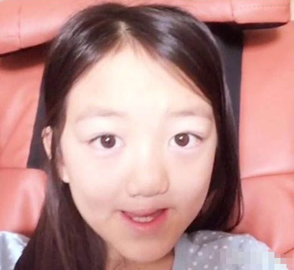 王菲女儿和冯小刚女儿同有"兔唇",俩孩子长大后,差距很明显
