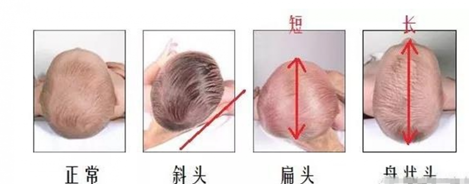 脑勺高聪明包这样头型的宝宝更聪明家长别再被误导了
