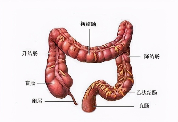 溃疡性结肠炎是一种较为常见的肠道性疾病,得了溃疡性结肠炎是非常