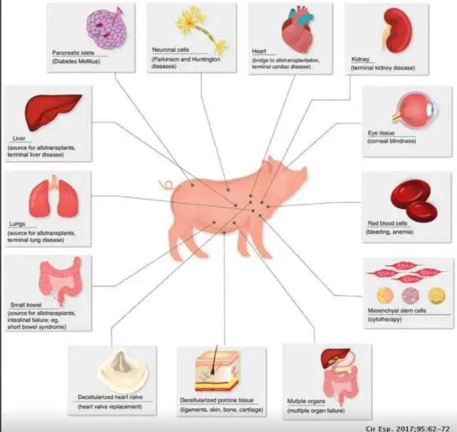 异种器官移植!未来十年,这项科幻般的技术可能颠覆性出现!