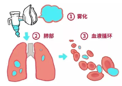 雾化吸入怎么做比较好?需要注意什么?