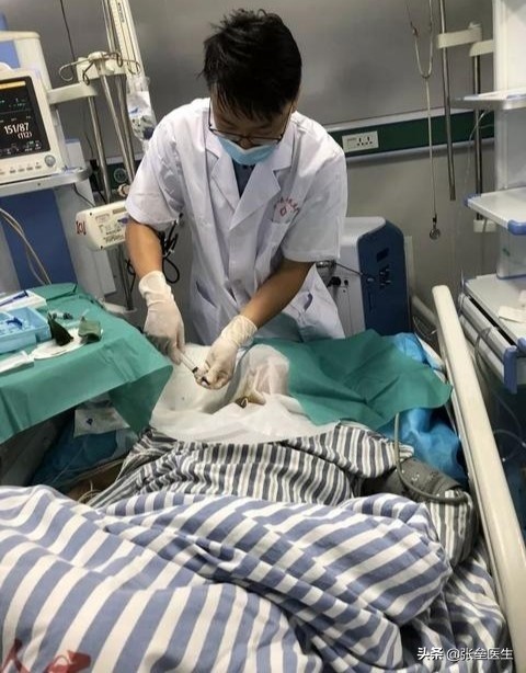 透析了,医生为什么要在病人脖子或腿上插根管子?原来是这种作用