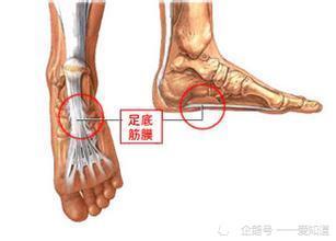 成语平足什么_平足是什么样子图片(2)