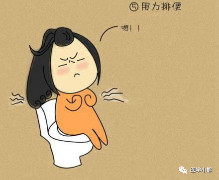 痔疮究竟会不会引发癌变?