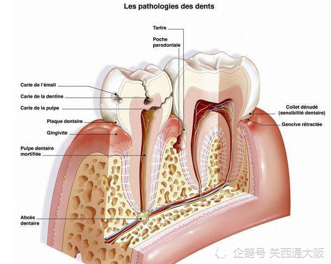 jpstemcell|日本干细胞helene诊所治疗牙周炎