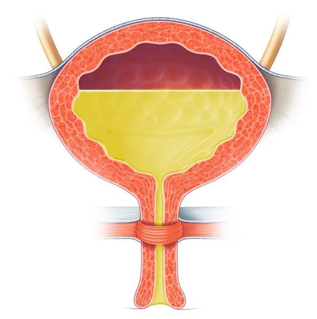 膀胱为一贮尿的肌性器官,构成膀胱壁的平滑肌称为逼尿肌,在膀胱与尿道