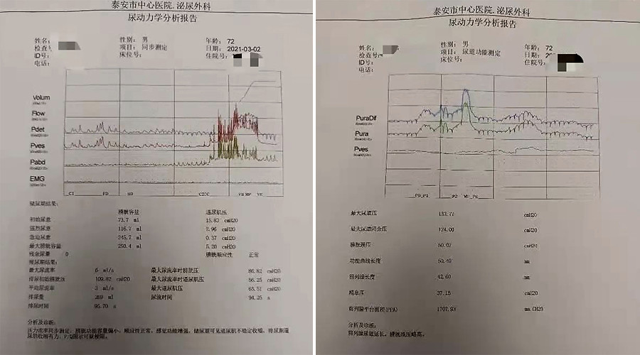 山东省泰安市中心医院泌尿外科首次开展尿动力学检查 腾讯新闻