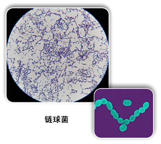 无乳链球菌,又称b族溶血性链球菌(groupbstreptococcus,gbs),存在于