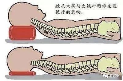 姿势不对起来重睡这才是颈椎病的正确睡姿