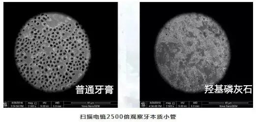 羟基磷灰石中引入锶元素后,可以增加口腔中的钙,磷离子活性和浓度
