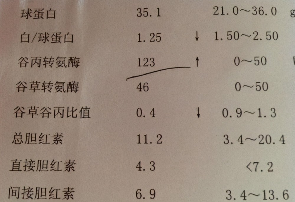 低烧简谱_低烧温度计图片(3)