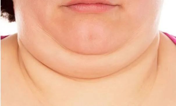 研究发现:脖子粗,肚子大的人基本和长寿无缘!