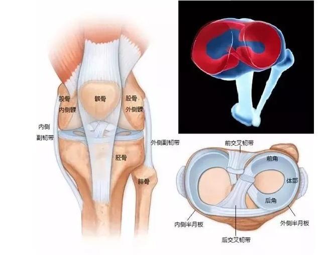 年轻人成半月板损伤主要群体,如何守卫半月板健康