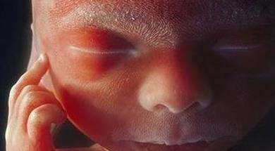 你见过28周胎儿的样子吗?一张图萌化无数宝妈的心,太可爱了