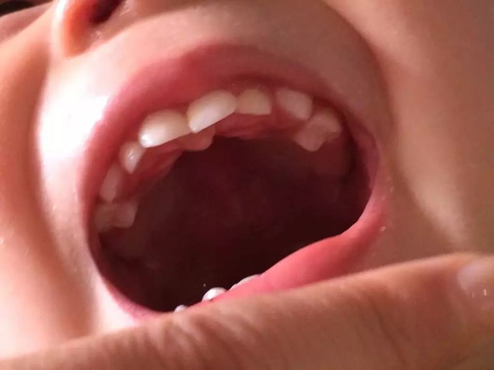 宝宝的长牙时间,一张图让你秒懂宝宝长牙顺序!
