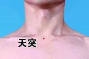 【图解天突穴位的位置】【天突穴的位置】位于人体颈部,当前正中线上