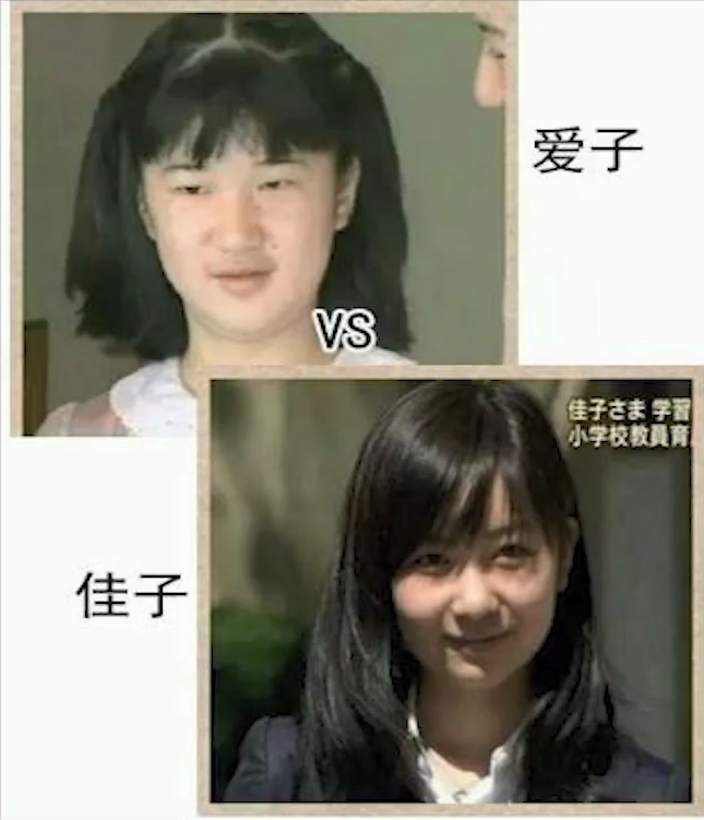 "日本最丑公主"爱子:被网暴后暴瘦几十斤,还遭受校园霸凌