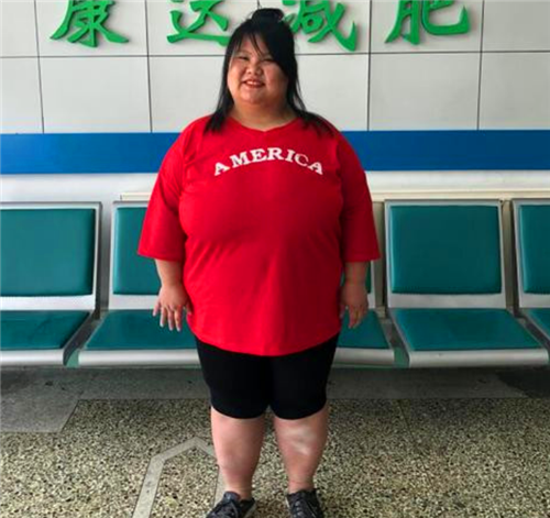还记得被男友养到300斤的安徽女孩吗曾睡塌3张床如今已认不出