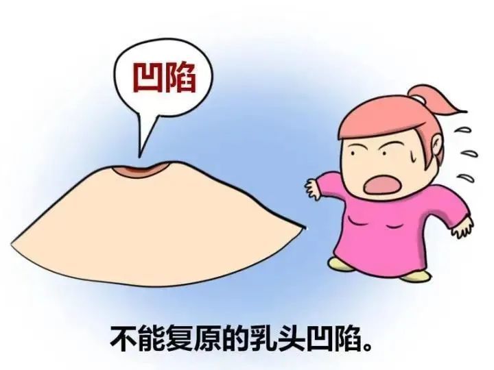 乳头,乳晕异常