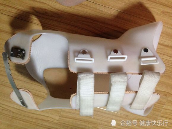 上海强直医院脊柱矫正中心解惑:脊柱侧弯患者穿戴支具后要复查吗