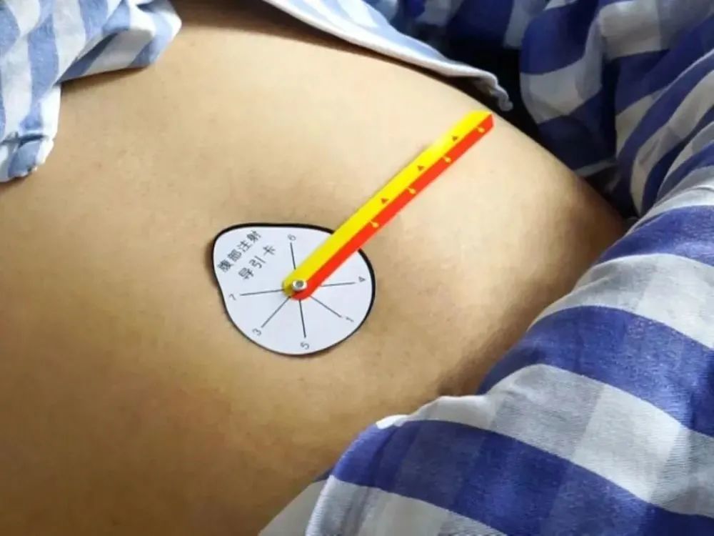 这项护士小发明,用于腹部注射简单实用