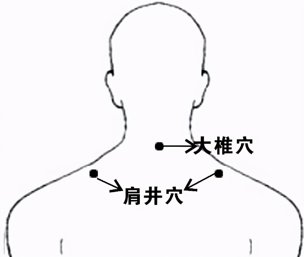 颈椎病严重,疼痛难忍,按摩什么穴位最有效?