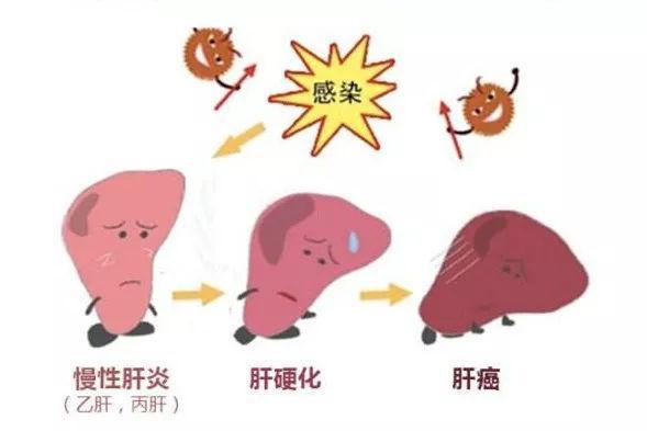 肝炎与病毒性肝炎,这两者之间有何关系呢?谁比较严重?