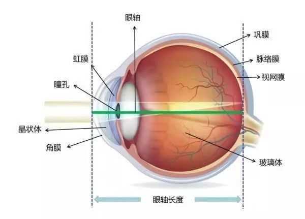 眼睛结构你了解吗究竟什么是屈光不正