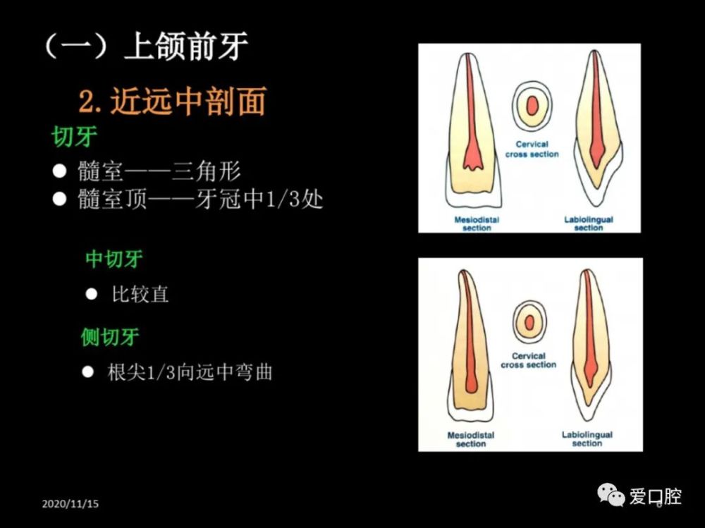 恒牙髓腔形态解剖特点