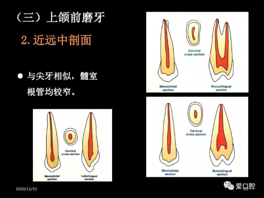 恒牙髓腔形态解剖特点