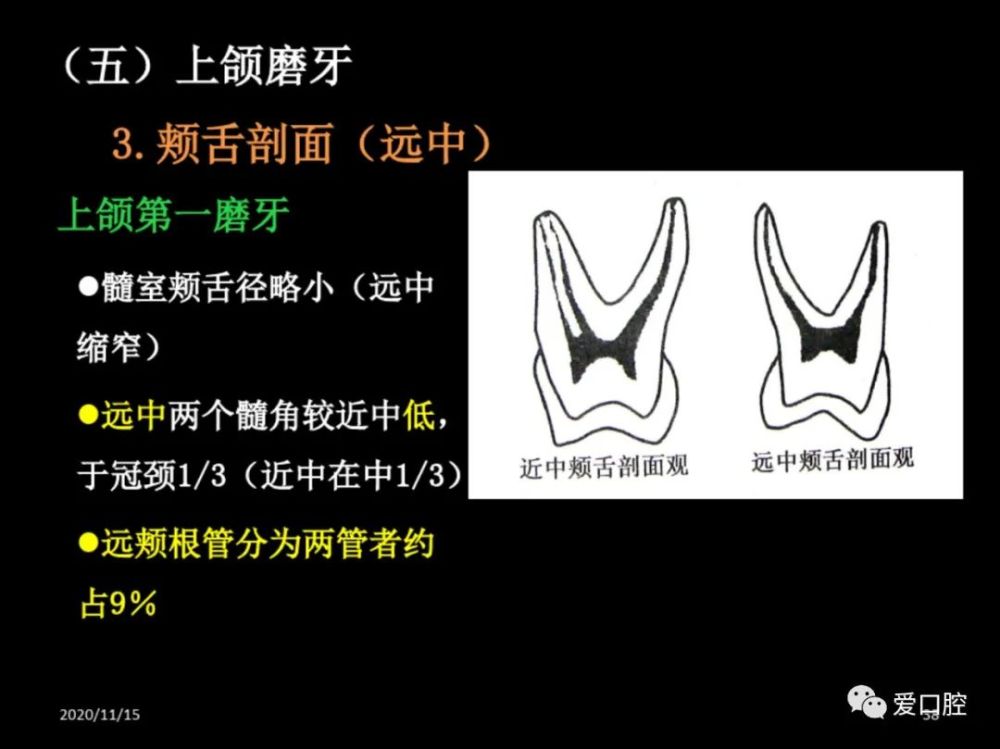 恒牙髓腔形态解剖特点