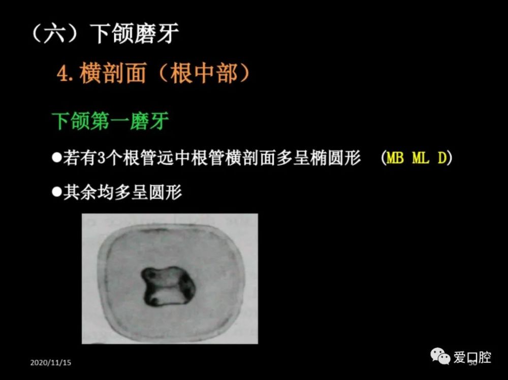 恒牙髓腔形态解剖特点