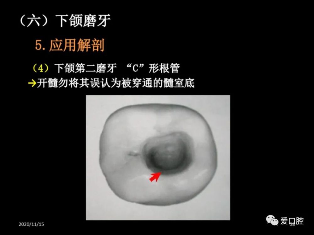 形态讲解 无牙颌解剖标志 干槽症的治疗方法 颌面部解剖之认识下颌骨